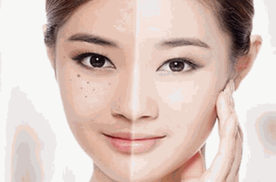 医肤颜坊祛斑祛痘